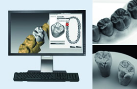 設計ソフトウェアのライブラリでは、様々な歯牙モデルから形態を選択することが可能。